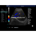 vascular doppler ultrasound & OB/GNY cardiac color doppler